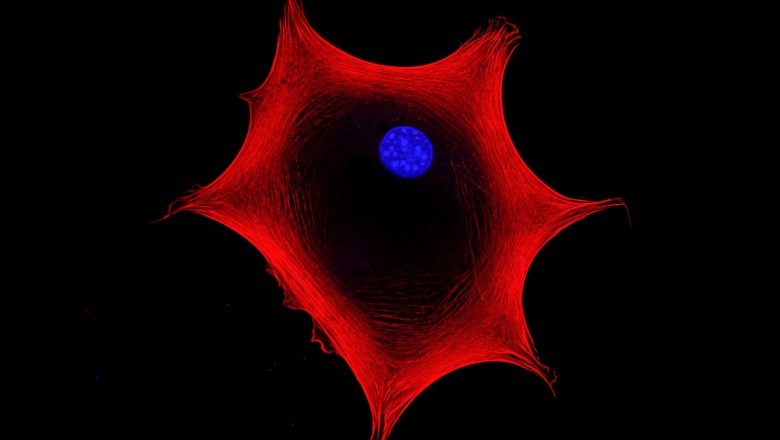 MSCs (mesenchymal stem cells) are one of the most important breakthroughs in medical research and disease management.