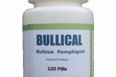 Treatment for Alopecia | Remedies | Herbal Care Products