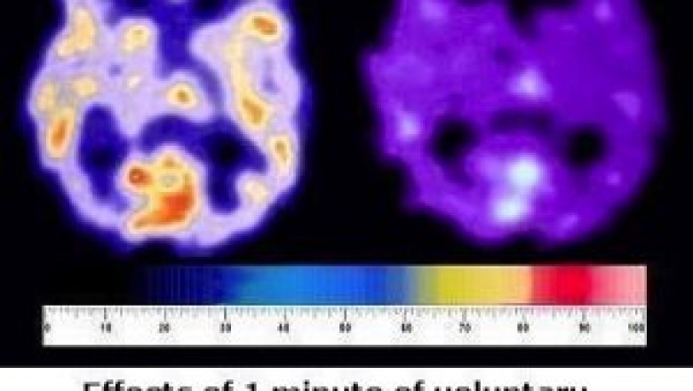 Home remedies for constipation