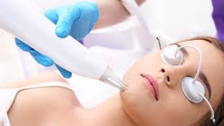Acne Treatment