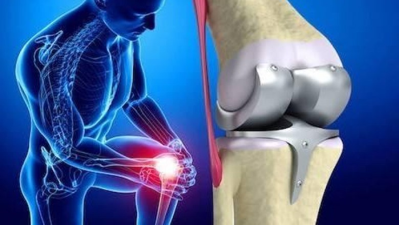 The global artificial joints market is oligopolistic, with a small number of companies dominating the majority of it.