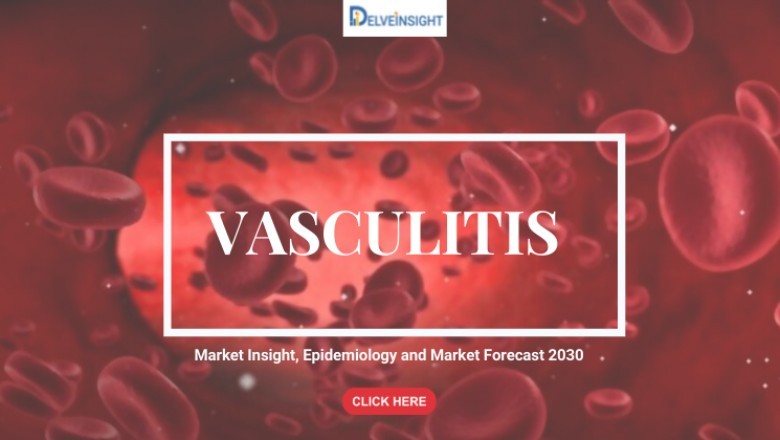 What is Vasculitis?