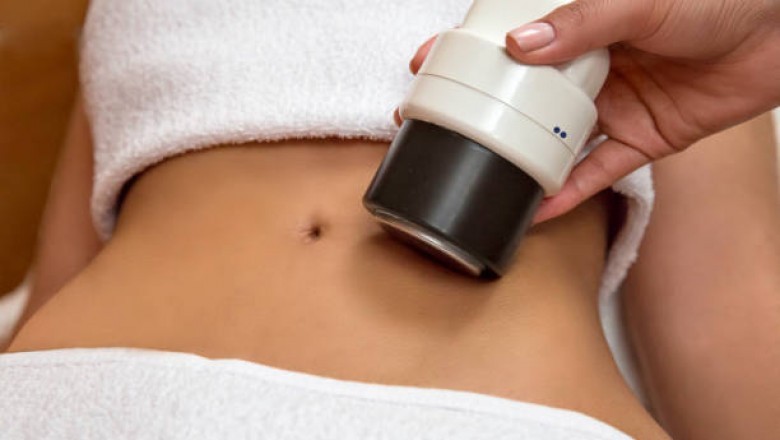 Coolsculpting Downtime
