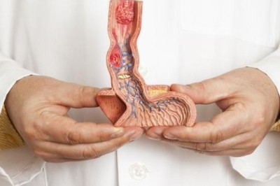 Gastric and Esophageal Cancer Drugs Market Trends Opportunity Analysis-2027