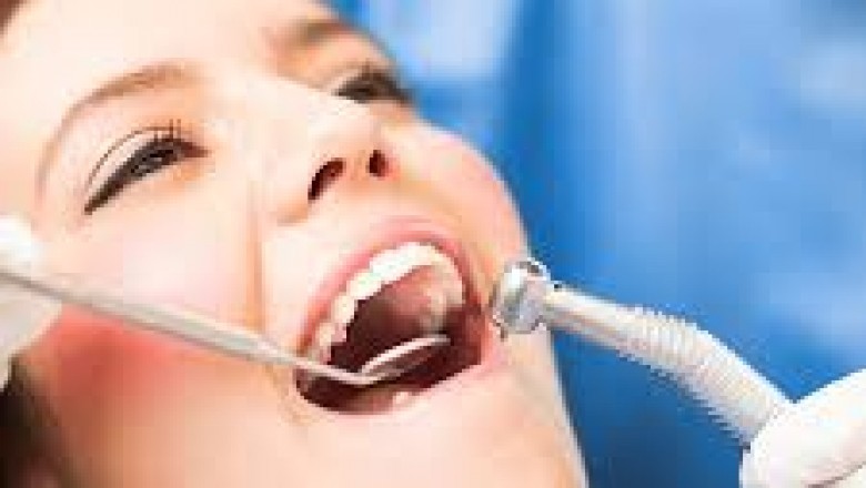 Why Do I Need Dental Veneers?
