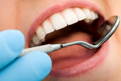 Tooth Colored Fillings in Nokomis | Dr. Keith Blessitt