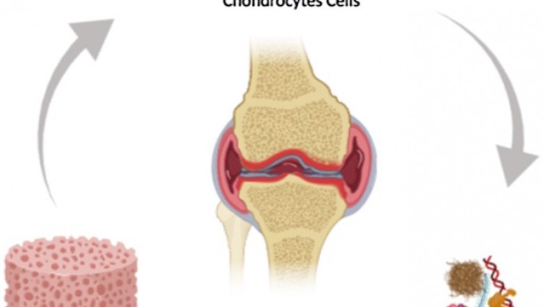 Growth in Sales of Europe Allogeneic Human Chondrocyte Market to Push Revenue Growth in the Market