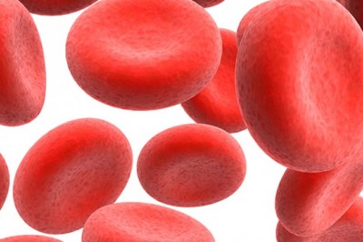 The Global Paroxysmal Nocturnal Hemoglobinuria Therapeutics Market Is Seeing Strong Demand Due to the Disease's Global Incidence Rate