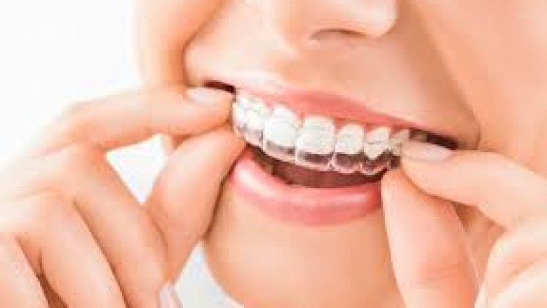 Find an Invisalign Doctor Near Me