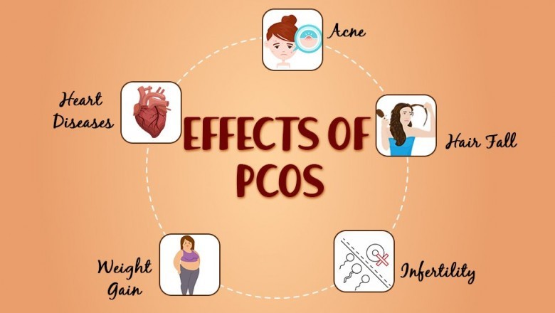 What is polycystic ovary syndrome?
