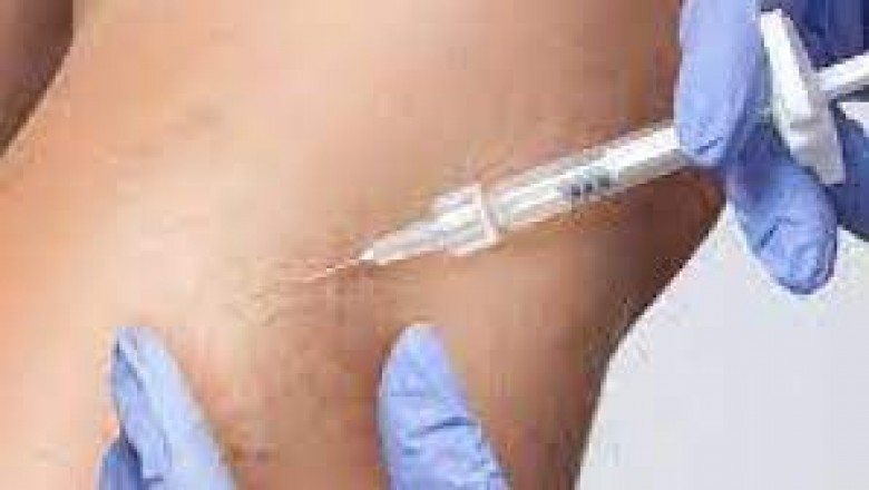 Chronic Venous Inadequacy: Everything You Should Know About