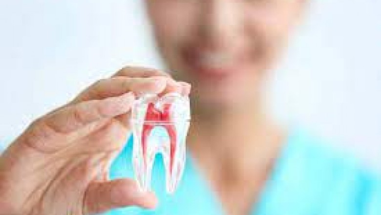 Five Reasons That You Need A Root Canal Treatment