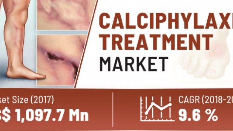 Calciphylaxis Treatment Market To Surpass US$ 2,400 Million By 2026