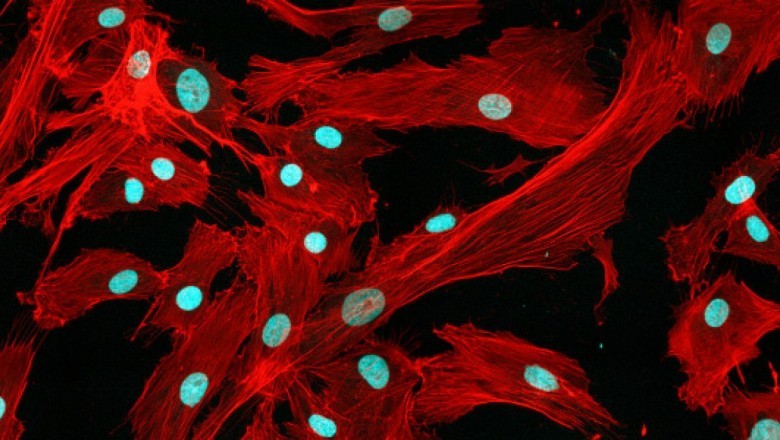 Mesenchymal Stem Cells Market Witnesses Upward Trend with High Prevalence of Parkinson’s Disease