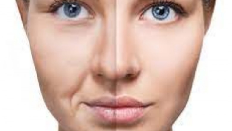 tratamiento flacidez facial