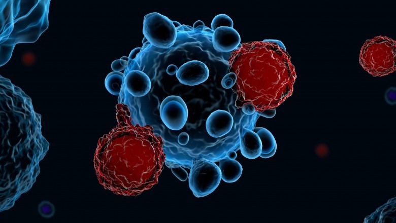 Non-Hodgkin’s Lymphoma Treatments Are a Type of Critical and Advanced Healthcare Treatments Given to Individuals Diagnosed with the Disease
