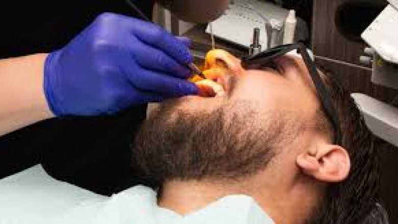 Walk in Dentist Houston TX