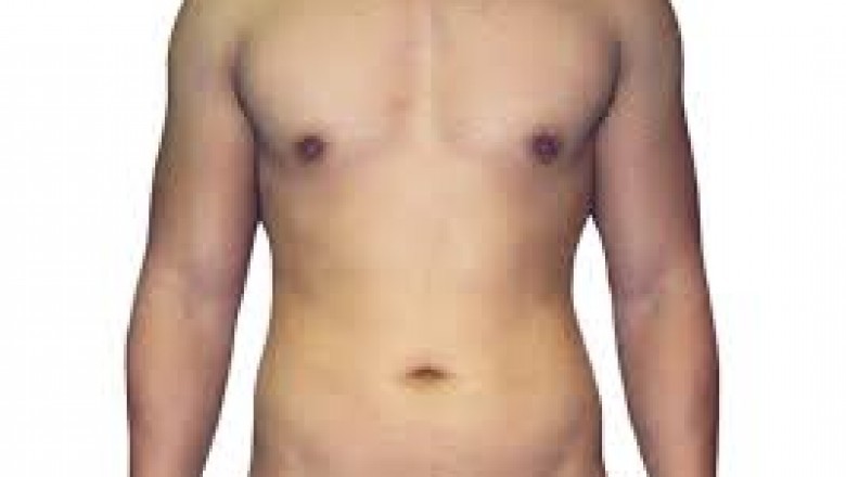 Liposculpture Expert in Houston