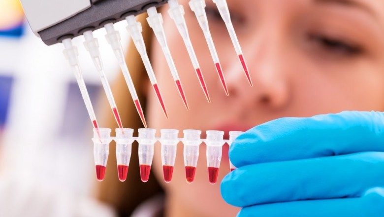 The epidermolysis bullosa therapeutic is dependent on the severity of the disease and might include simple topical medications as well as surgery.