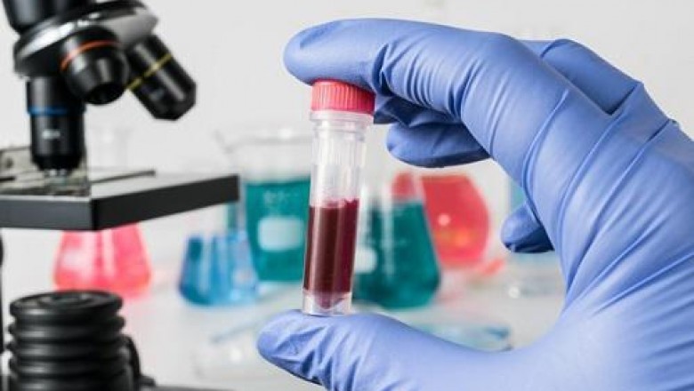 The main aim of the Clinical Laboratory Services is to provide high standard of patient care through cost-effective diagnostic and treatment services