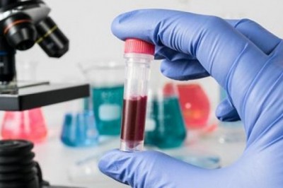 The main aim of the Clinical Laboratory Services is to provide high standard of patient care through cost-effective diagnostic and treatment services