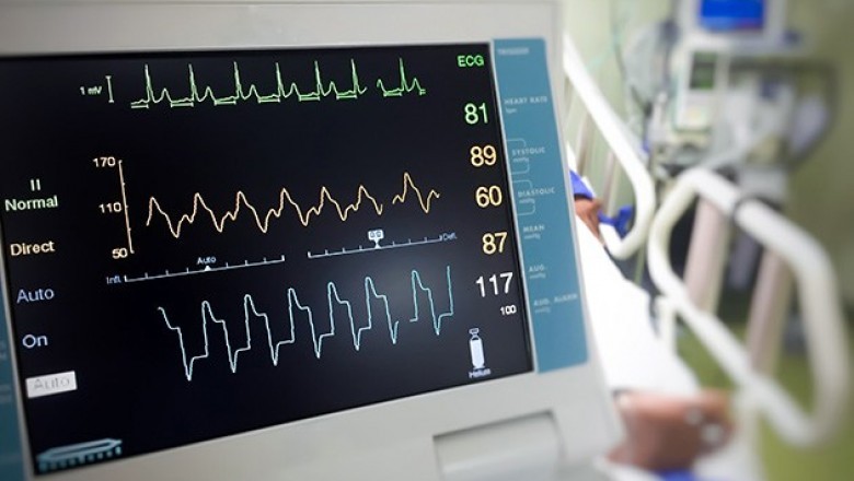 Two types of Cardiac Monitoring Devices are Cardiac Rhythm Monitoring Devices and Electronic monitoring devices