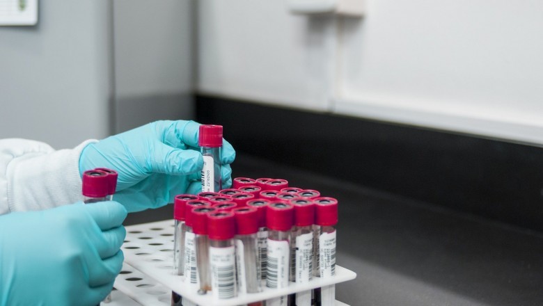 Global Gel Permeation Chromatography (GPC) By 2021 Coherent Marketing Insight