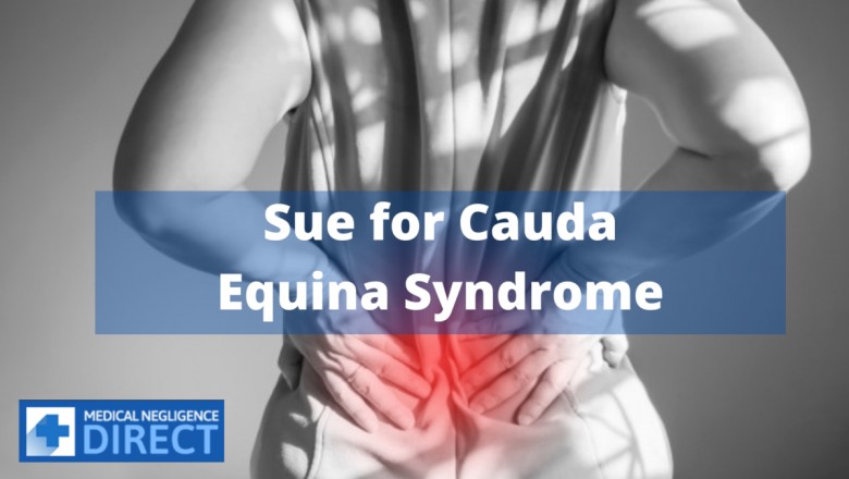 Sue for Cauda Equina Syndrome