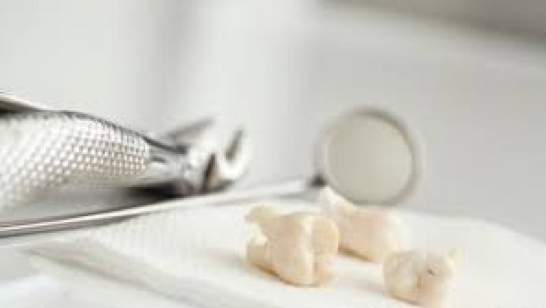 What are the Symptoms, Causes, and Treatment of Gum or Dental Abscess?