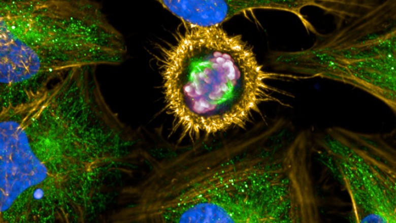 A group of analytical techniques used in genetic research and medication development is known as high-content screening.