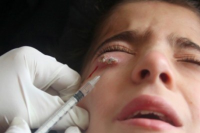 Drug choice, host immune response, and parasite strain are important components in leishmaniasis treatment effectiveness