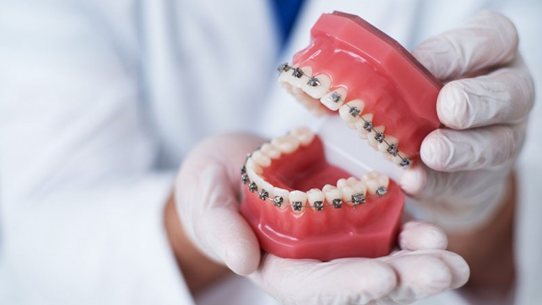 When to Visit an Emergency Dentist?
