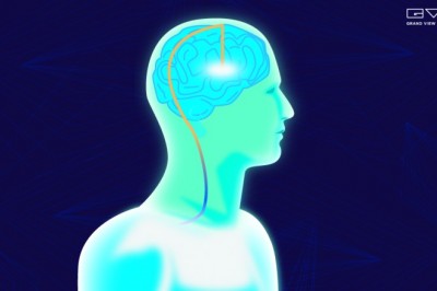 Brain Implants Market Size Worth $9.2 Billion By 2028