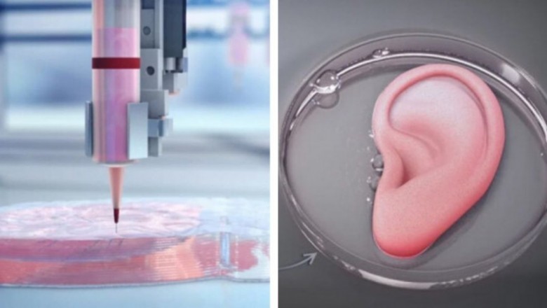 Functional 3D Printed Tissue is a technique that entails printing 3D models of living tissues on a fine-needle board.