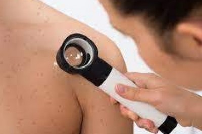 Acute Bacterial Skin and Skin Structure Infections (ABSSSI) affect the epidermis, dermis, or subcutaneous tissues in North America and Europe.
