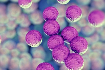 Adenylate Kinase Activity Detects Bacteria in Rapid Non-molecular Methicillin Resistant Staphylococcus Aureus (MRSA) Testing Systems