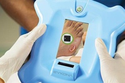 Digital Wound Measurement Devices Market Expansion Projected To Gain An Uptick During 2027