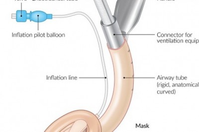 Future Scope of Airway Management Tubes Market | Estimated to Grow CAGR Rapidly | Foreseen till 2028