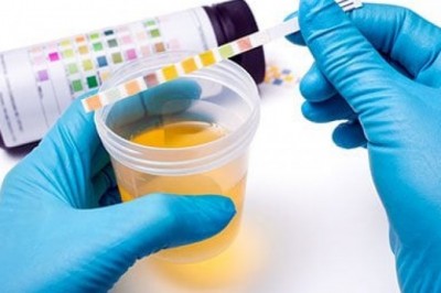 Global Urinalysis Market by Player, Region, Type, Application and Sales Channel 2021-2030