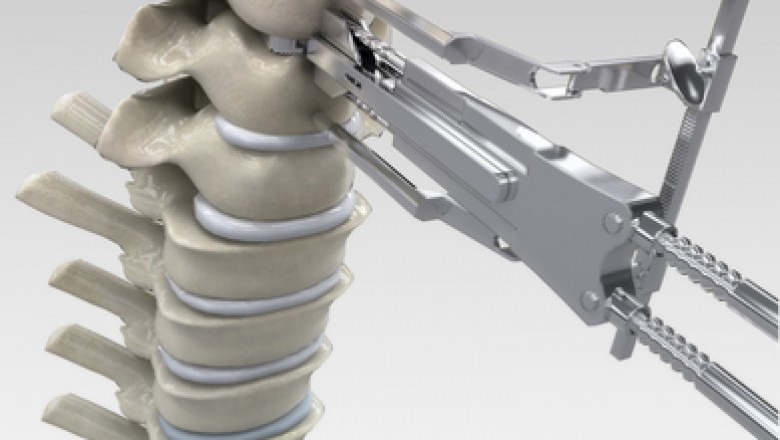 Lumbar Disc Replacement Devices Allow You to Move Normally Without Pain or Strain While Maintaining Full Range of Motion and Strength in Your Back Structure