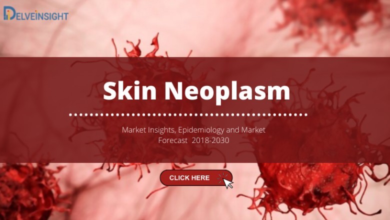 What is Skin Neoplasm Market?