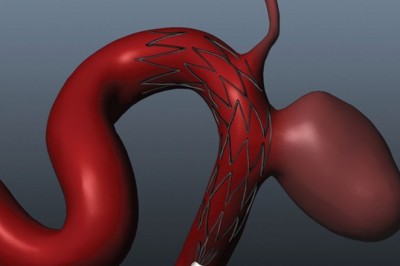 What will the Intracranial Stents Market size be in 2022 and what will the growth rate be?