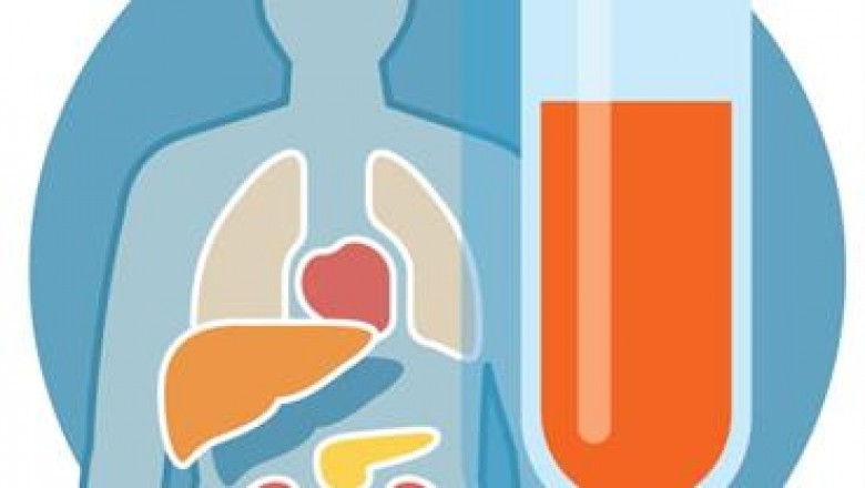 Biophysical technique is an alternative way of clinical Therapeutic Drug Monitoring