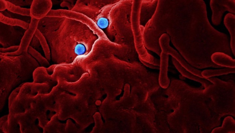 Latest Business Intelligence Solution for the Acanthocheilonemiasis Treatment Market | Foreseen Till 2028