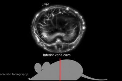 Photoacoustic Tomography Market -Global  Industry Trends and Forecast to 2026 | MILabs B.V., Northridge Tri-Modality Imaging, Inc., GENERAL ELECTRIC, Koninklijke Philips N.V.  MR Solutions