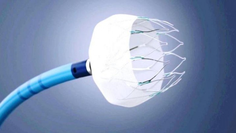 Transcatheter Embolization and Occlusion Devices Market Business Segmentation By Revenue And Structure Forecast 2027