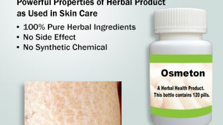 Natural Treatment for Ichthyosis | Supplement | Herbs Solutions By Nature