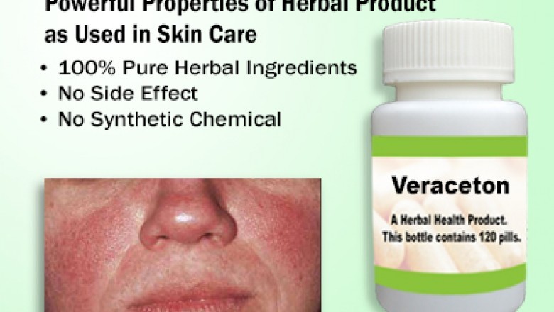 Natural Treatment for Polycythemia Vera | Supplement | Herbs Solutions By Nature