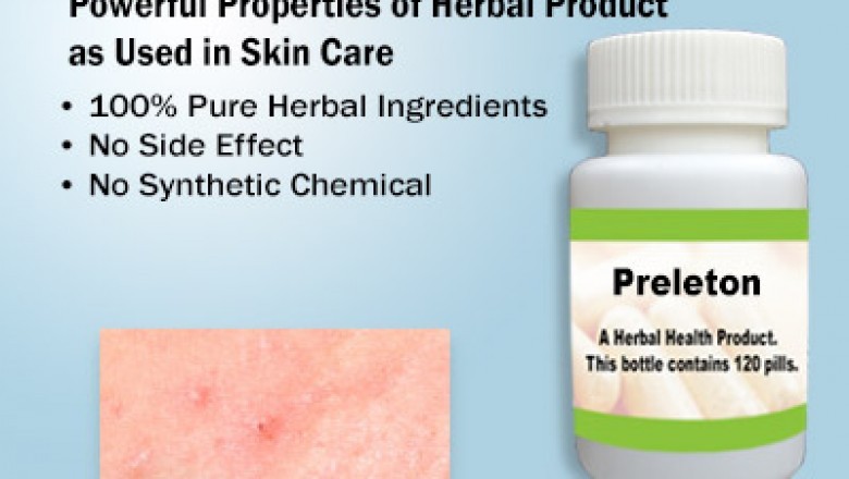 Natural Treatment for Prickly Heat | Supplement | Herbs Solutions By Nature