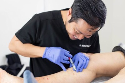 What are the Alternatives to Vein Stripping Procedure for Varicose Vein Treatment?